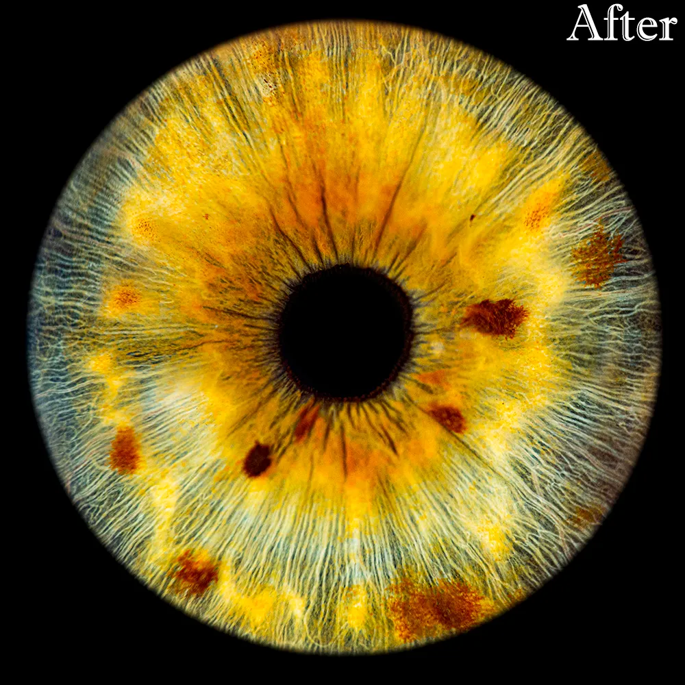 Iris photo__After